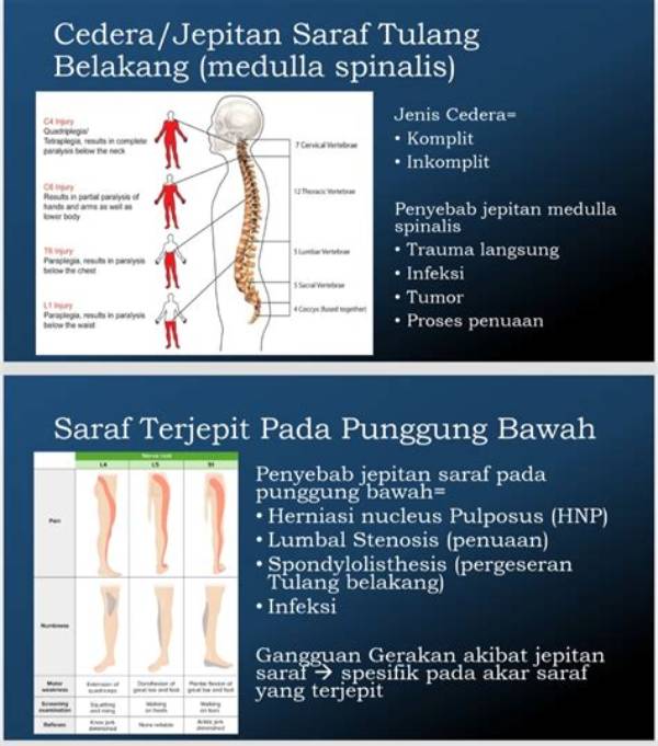 Komplikasi Medis Pada Suasana Saraf Yang Di